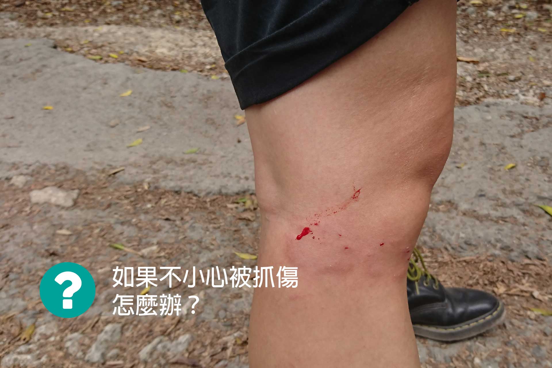 如果不小心被抓傷怎麼辦